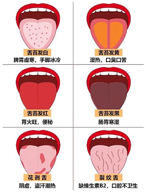 舌顏色